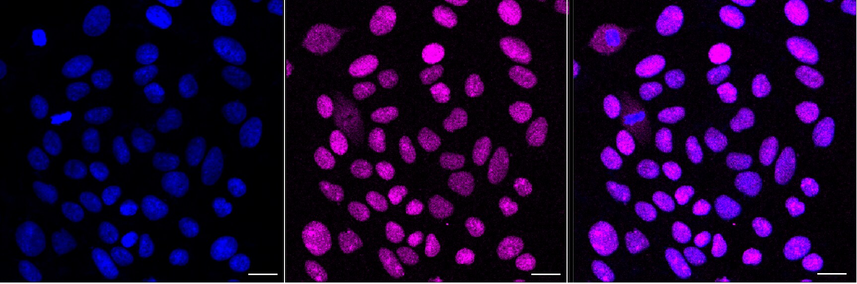 SSB Antibody (24GB13175)