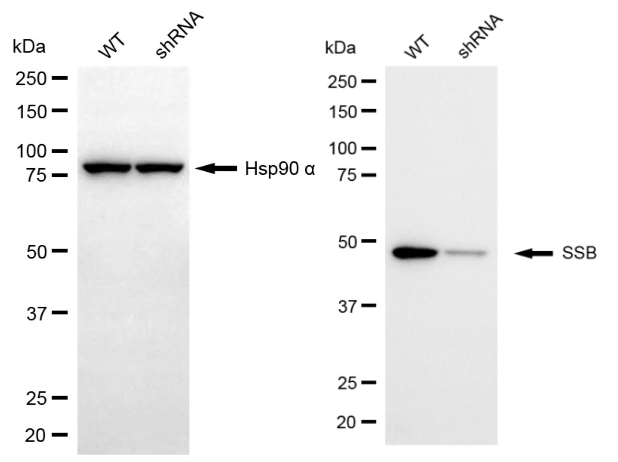 SSB Antibody (24GB13175)