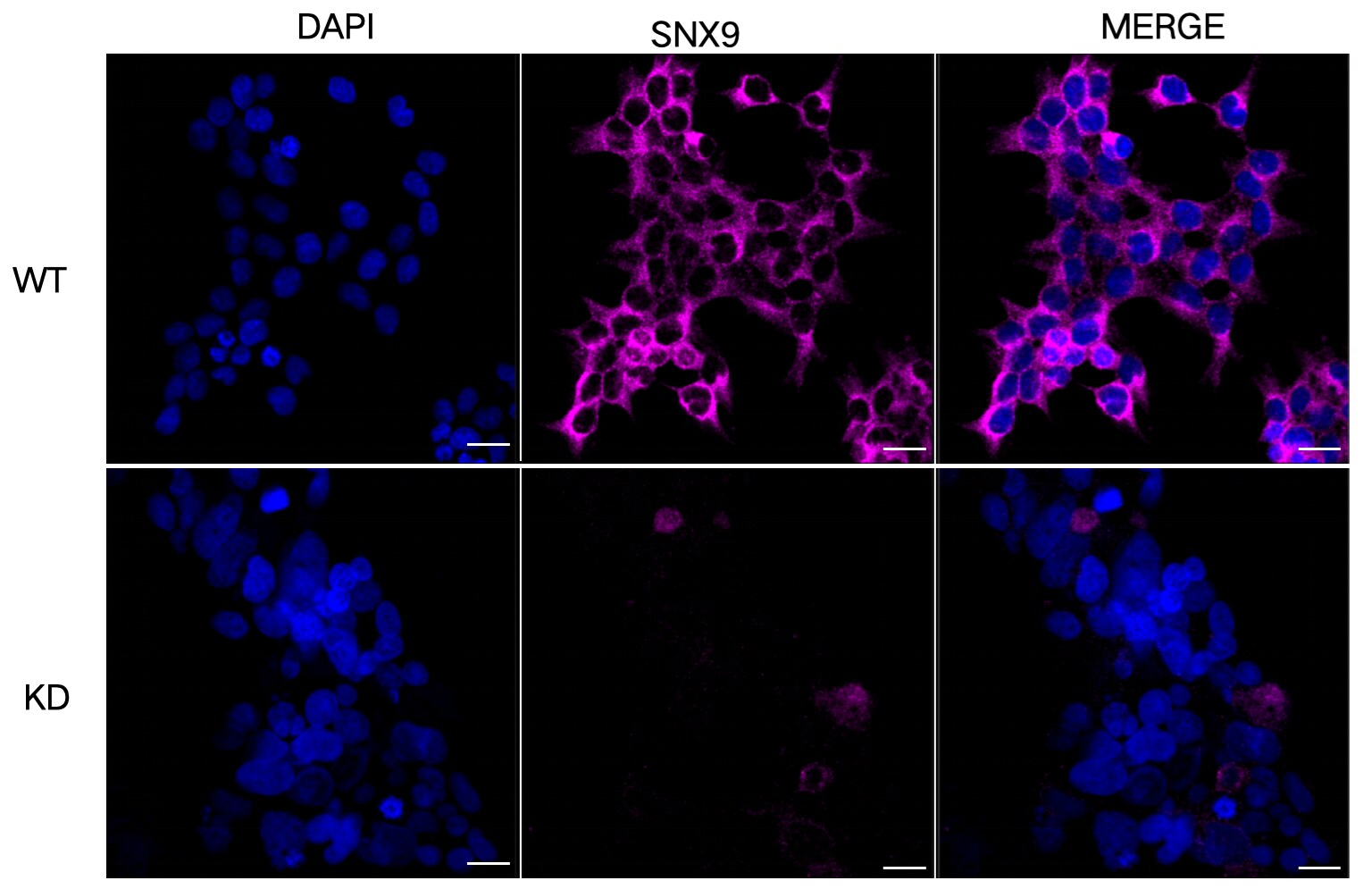 SH3PX1 Antibody (24GB13195)