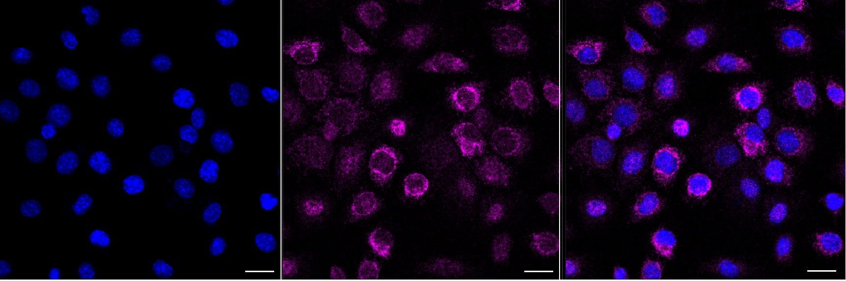 IFN-gamma R1/CD119 Antibody (24GB13660)