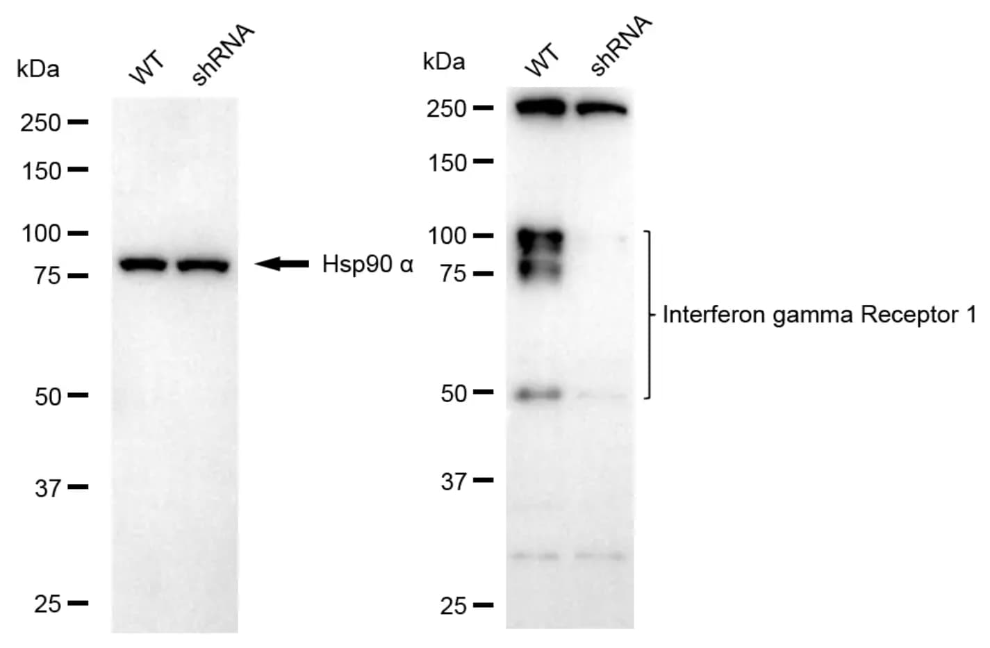 IFN-gamma R1/CD119 Antibody (24GB13660)
