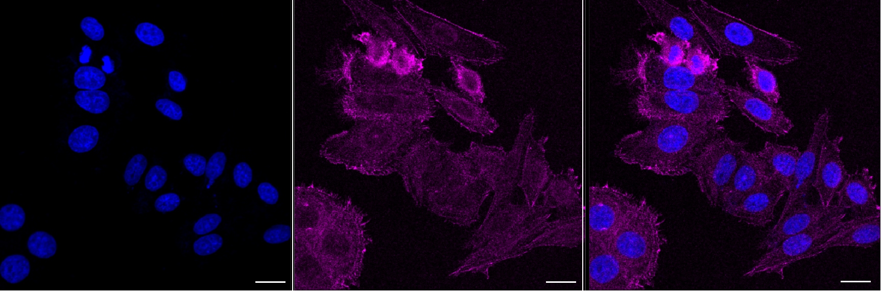 PDLIM7 Antibody (24GB13710)