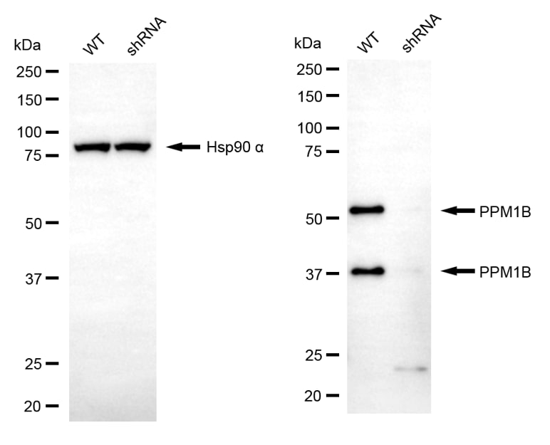 PP2C beta/PPM1B Antibody (24GB13970)