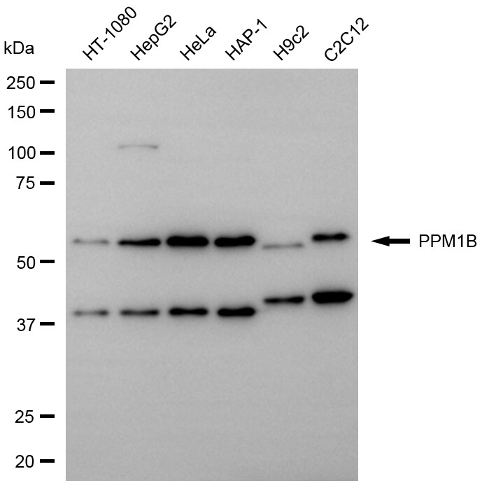 PP2C beta/PPM1B Antibody (24GB13970)