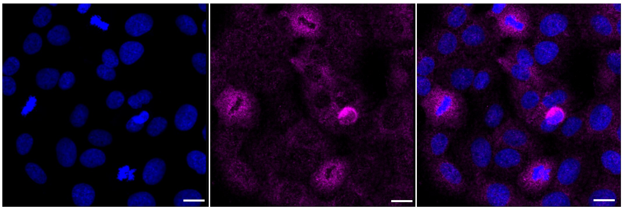 PRAS40 Antibody (23GB645)