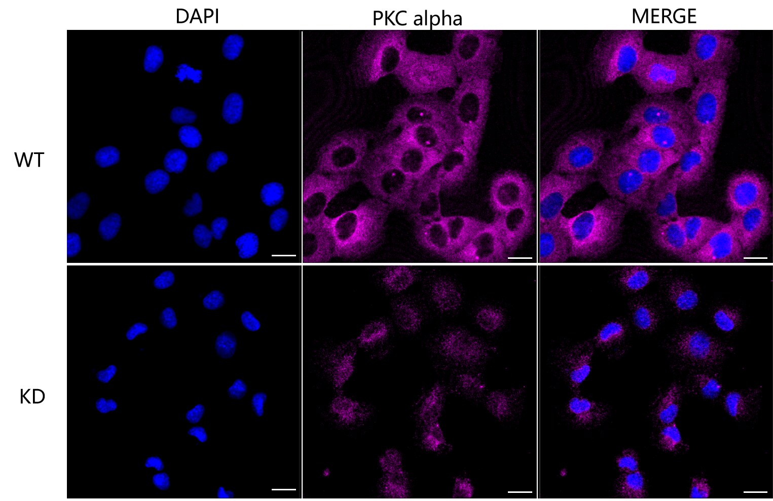PKC alpha Antibody (23GB1690)