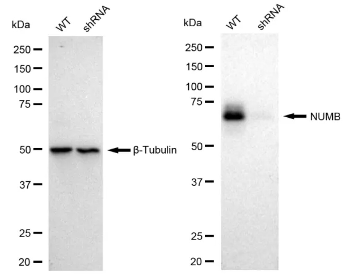 Numb Antibody (23GB1070)