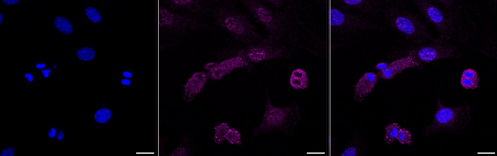 ACTR2 Antibody (23GB610)