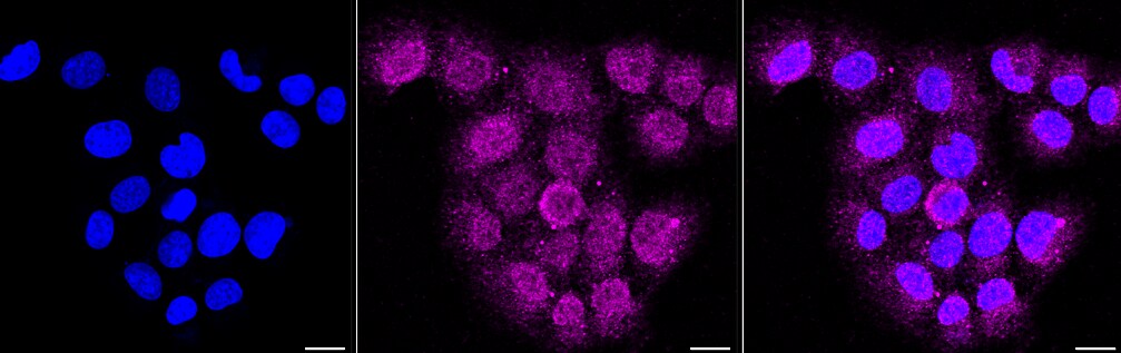 Integrin beta 1/CD29 Antibody (23GB885)