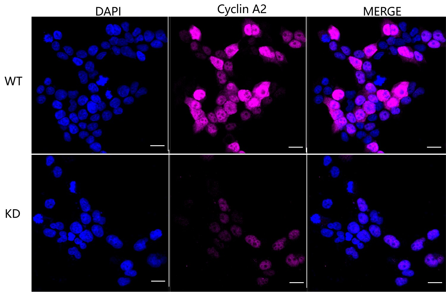 Cyclin A2 Antibody (23GB1875)