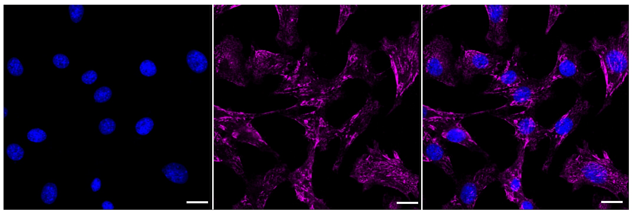Integrin alpha 5/CD49e Antibody (23GB1050)
