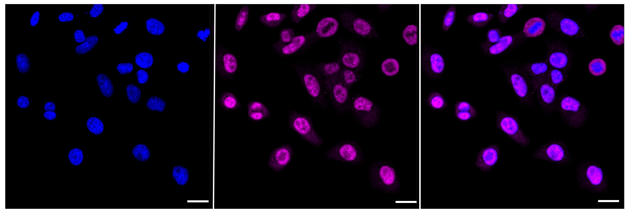 CHD3 Antibody (23GB1380)