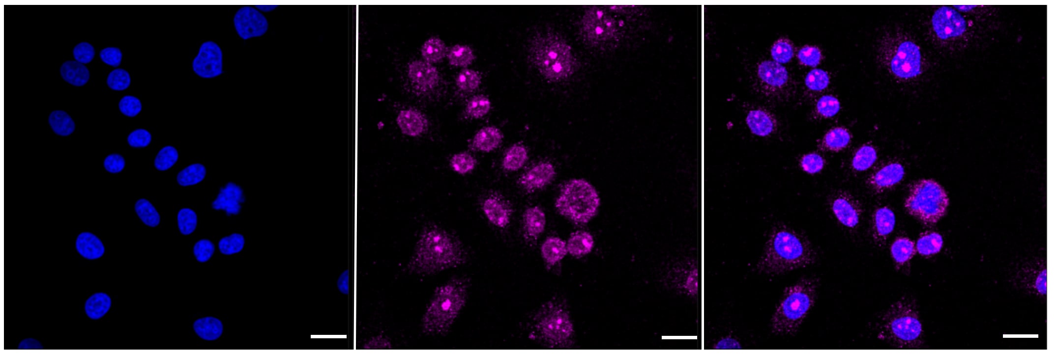 GSK-3 alpha/beta Antibody (23GB1100)