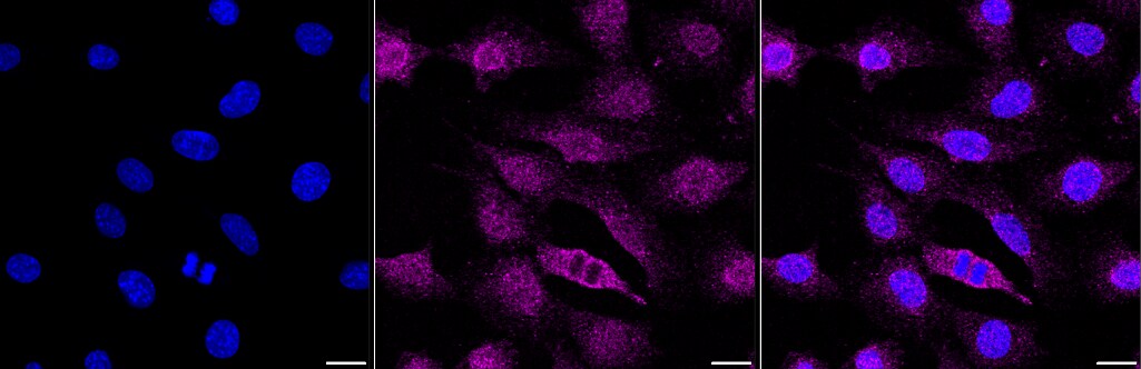 Smad4 Antibody (23GB975)