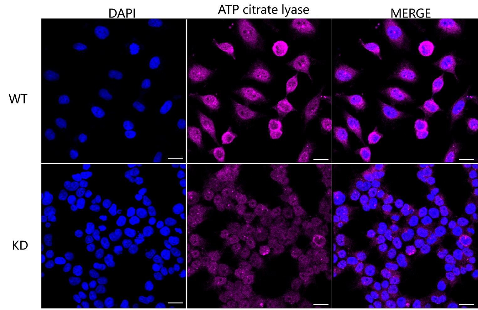 ATP Citrate Lyase Antibody (23GB1620)