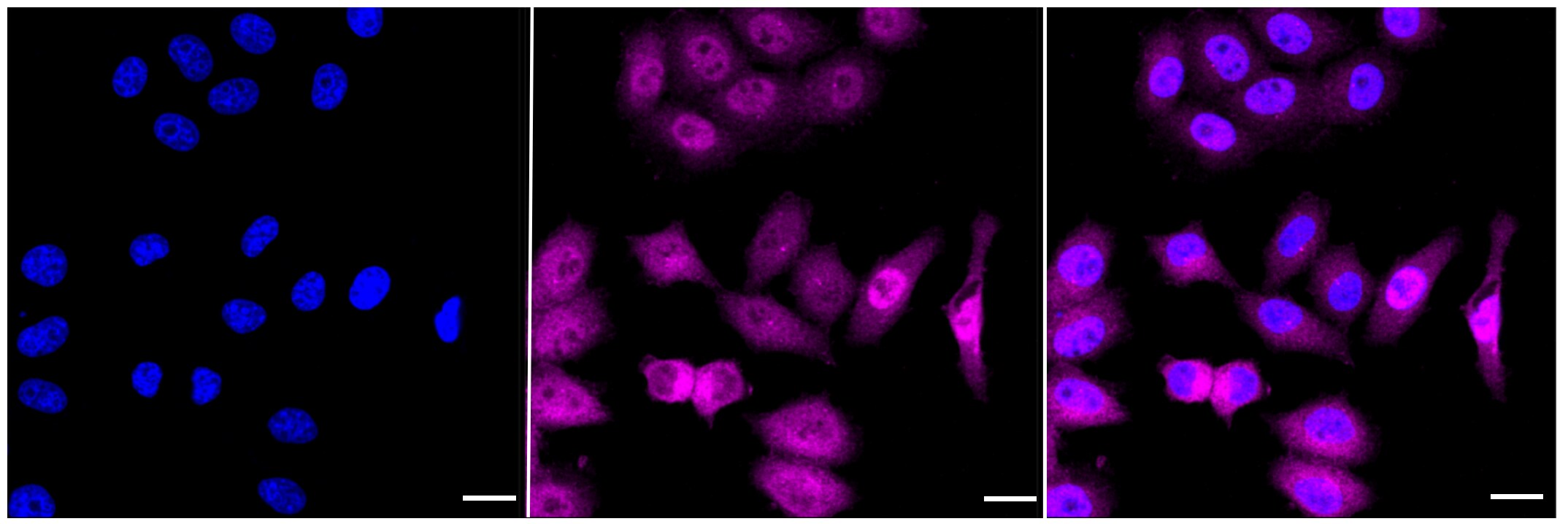 ATP Citrate Lyase Antibody (23GB1620)