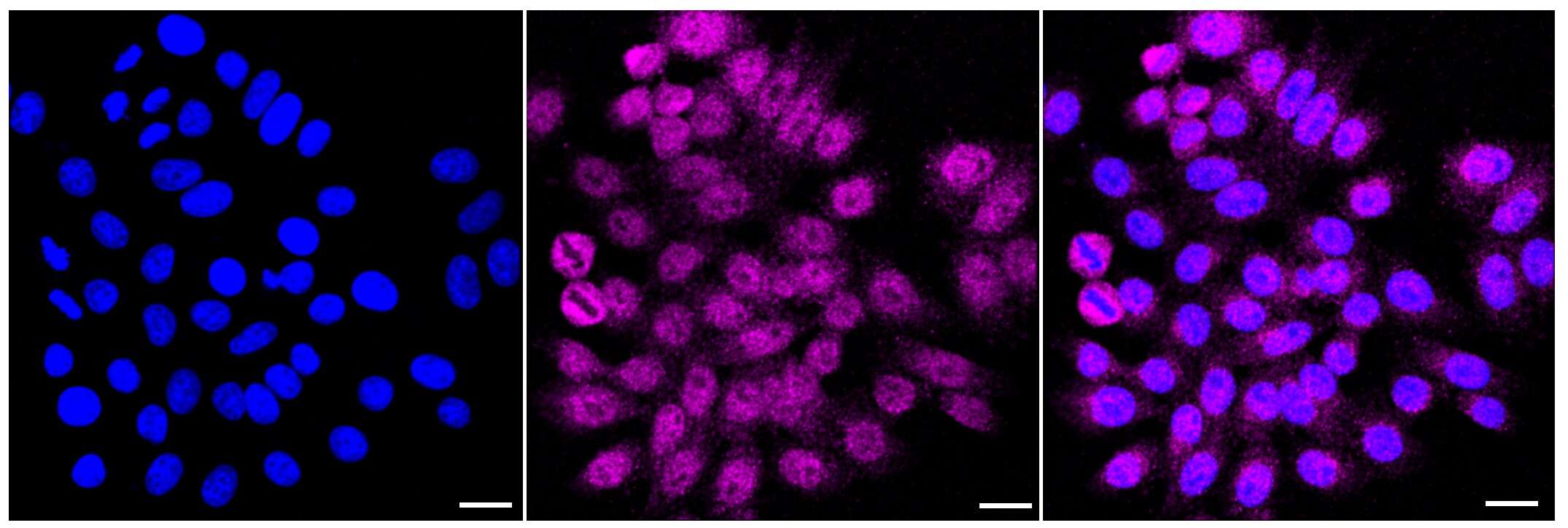 VAMP-2 Antibody (23GB1855)