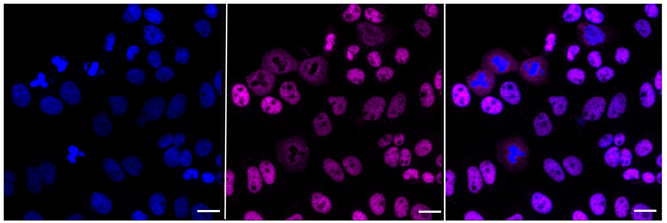 MCM7 Antibody (23GB925)