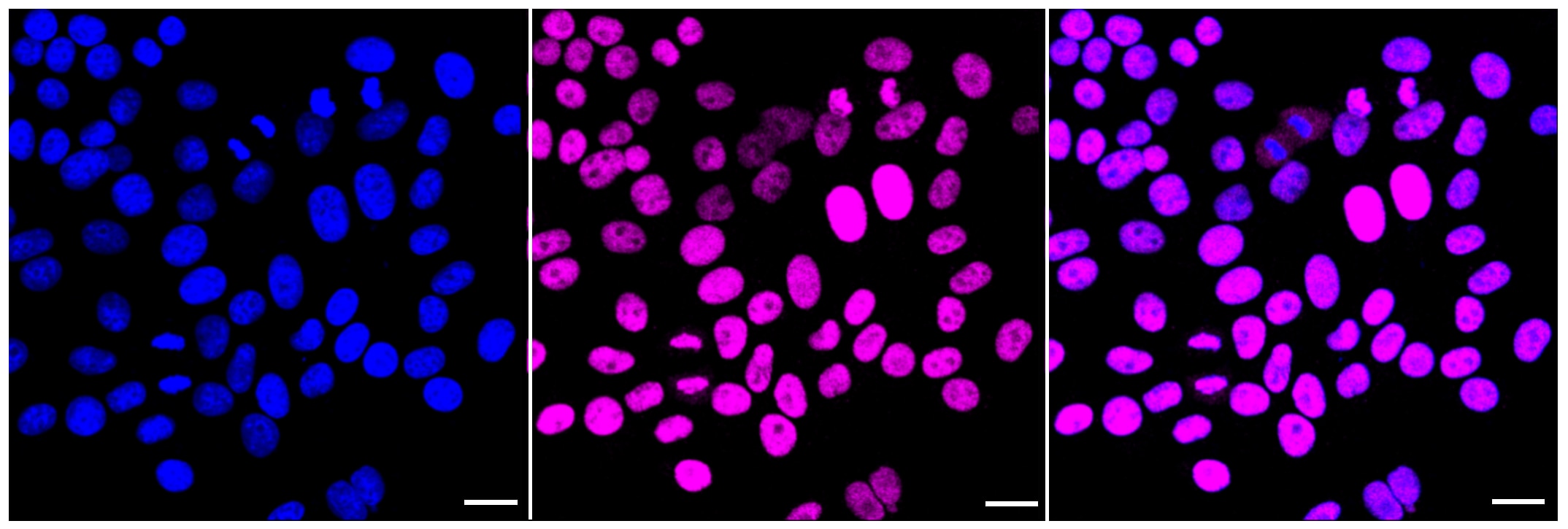 CHD3 Antibody (23GB1305)