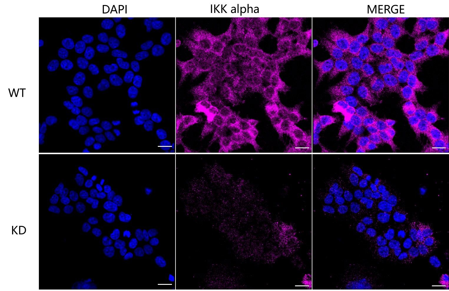 IKK alpha Antibody (23GB1065)