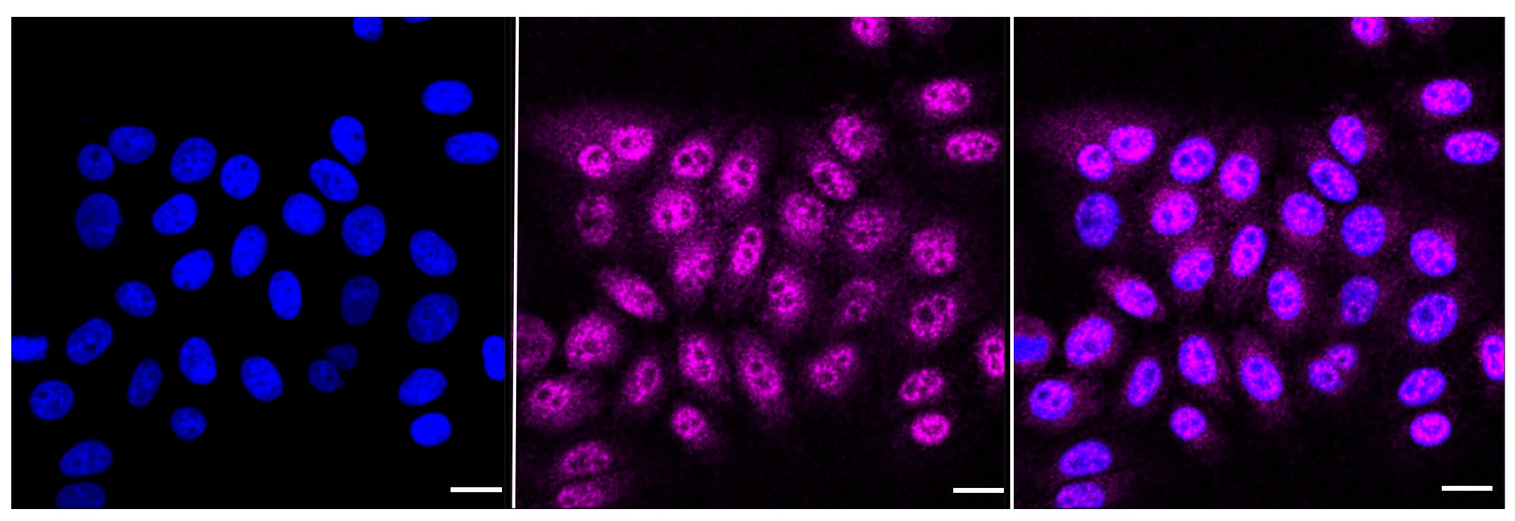 IKK alpha Antibody (23GB1065)