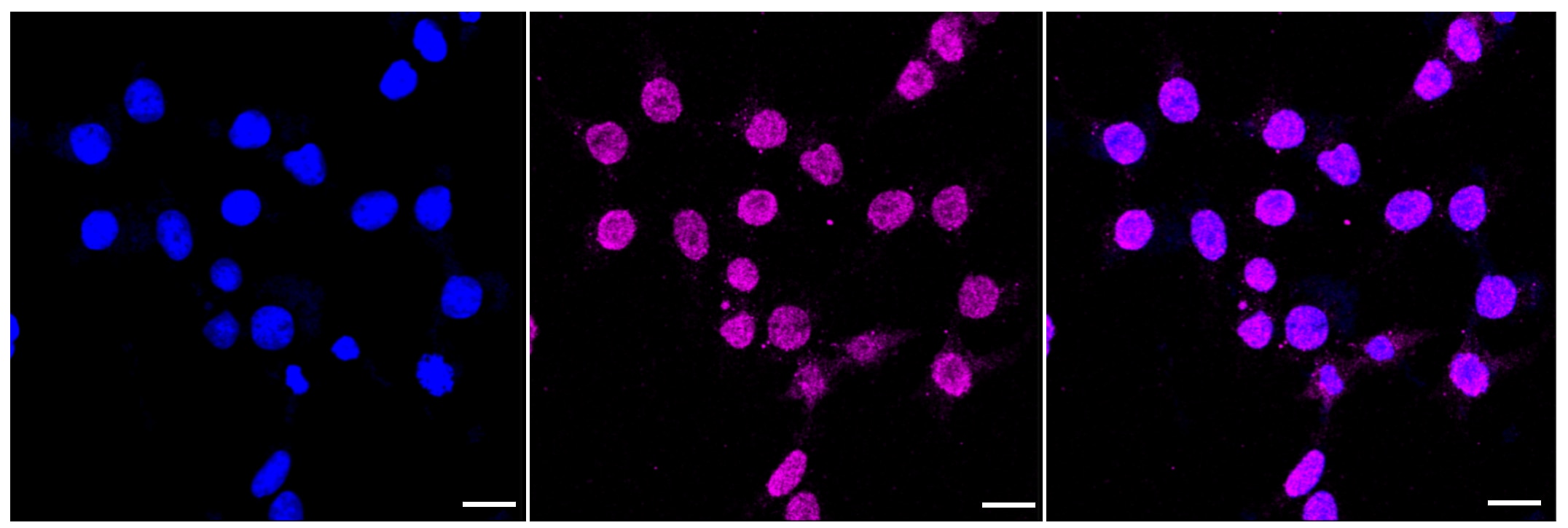 CD163 Antibody (23GB3750)
