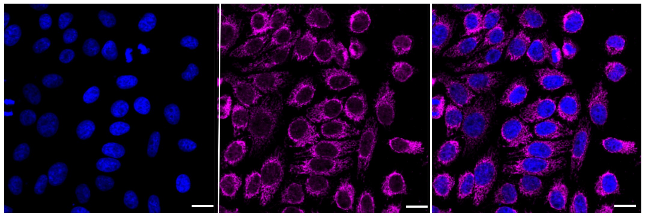 CLPP Antibody (23GB1865)