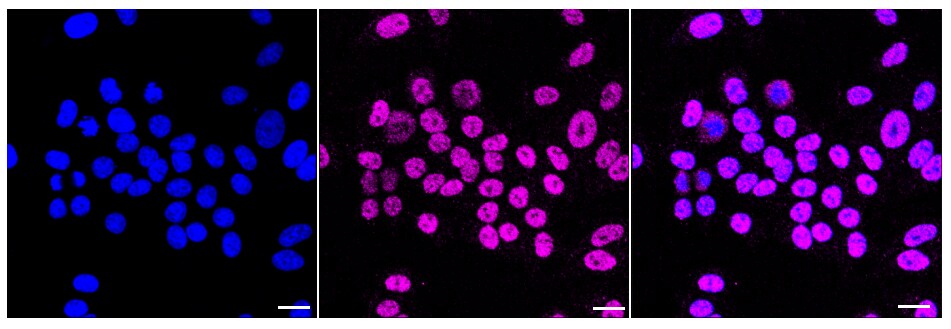 HNF-3 alpha/FoxA1 Antibody (23GB1170)