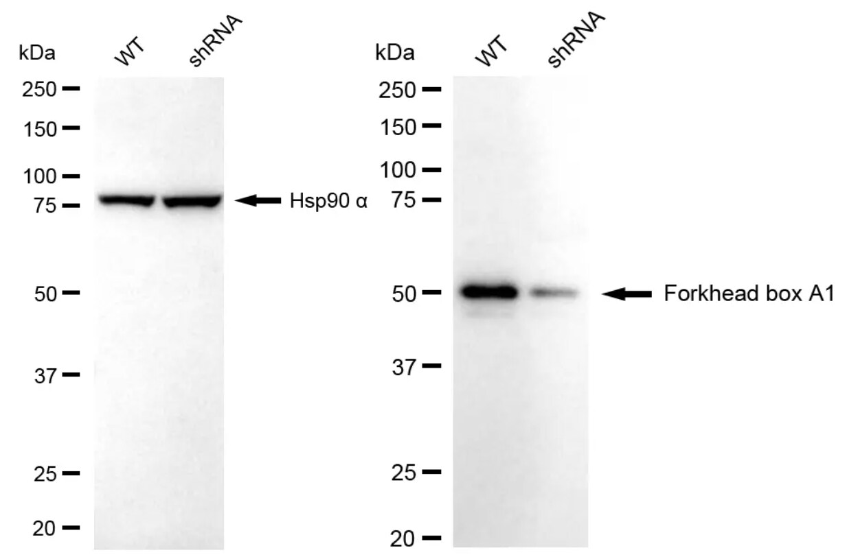 HNF-3 alpha/FoxA1 Antibody (23GB1170)