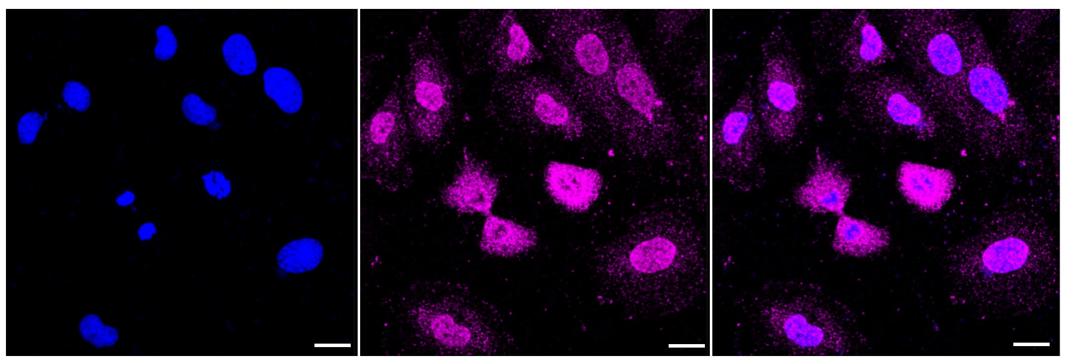 BMP-6 Antibody (23GB3705)