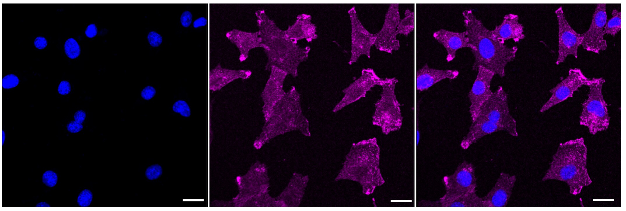 Aquaporin 1/AQP1 Antibody (23GB1850)
