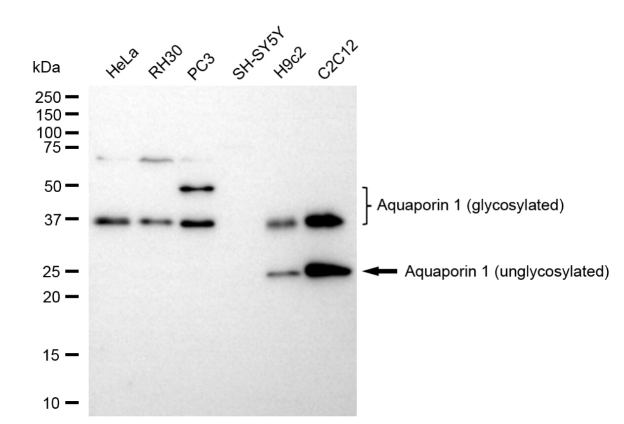 Aquaporin 1/AQP1 Antibody (23GB1850)