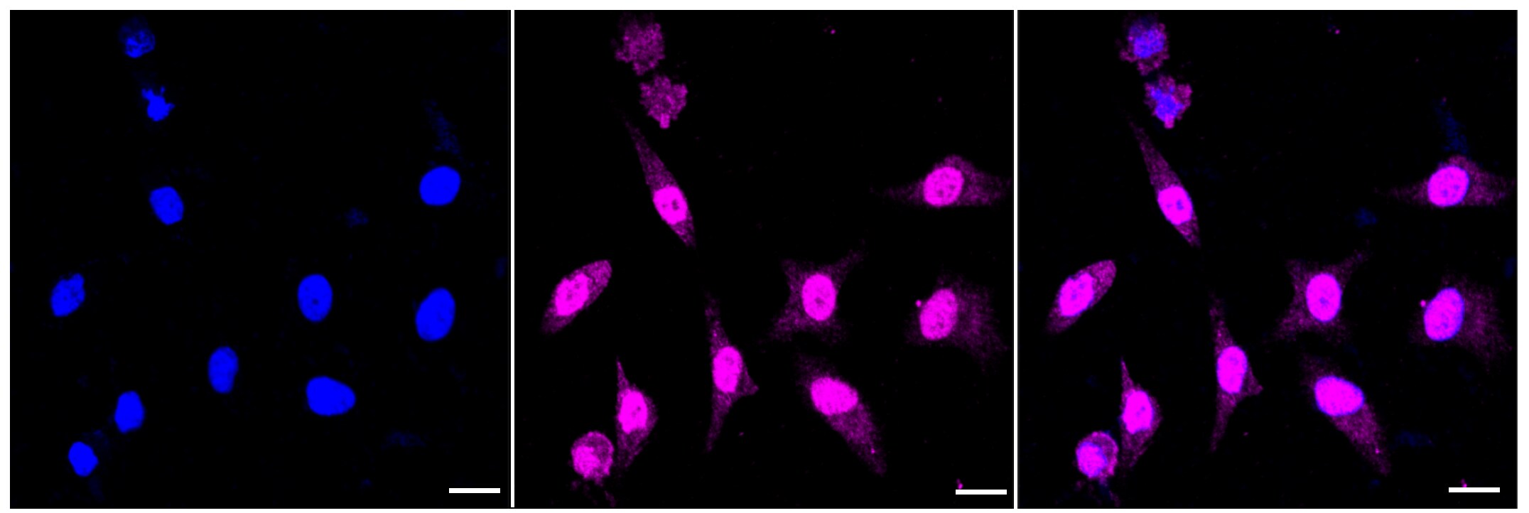 LAMP-2/CD107b Antibody (23GB4040)