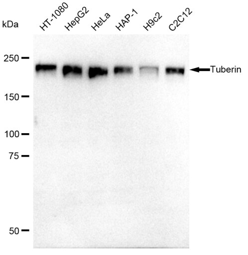 TSC2 Antibody (23GB1120)
