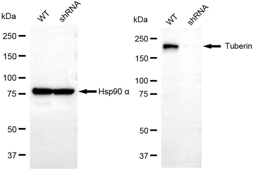 TSC2 Antibody (23GB1120)