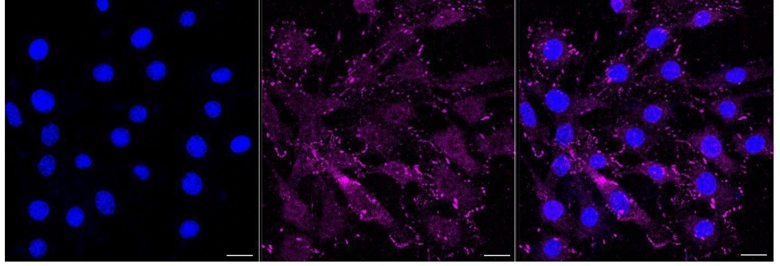 Integrin beta 3/CD61 Antibody (23GB900)