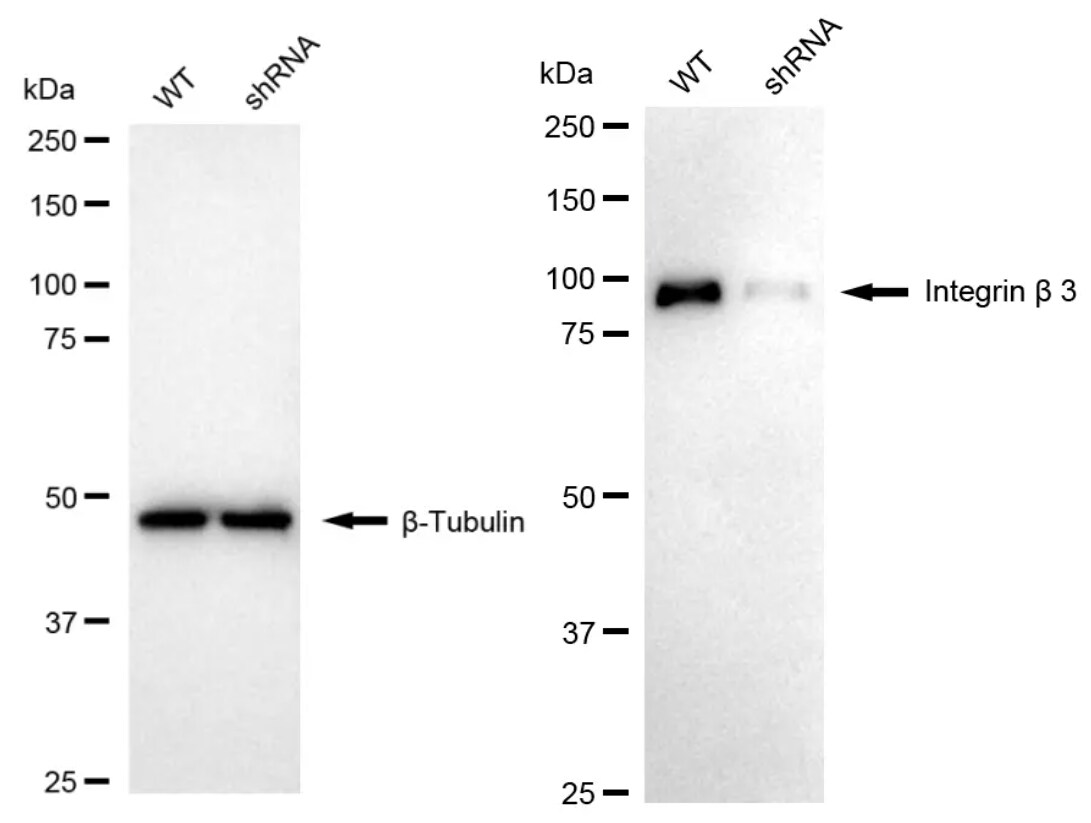 Integrin beta 3/CD61 Antibody (23GB900)