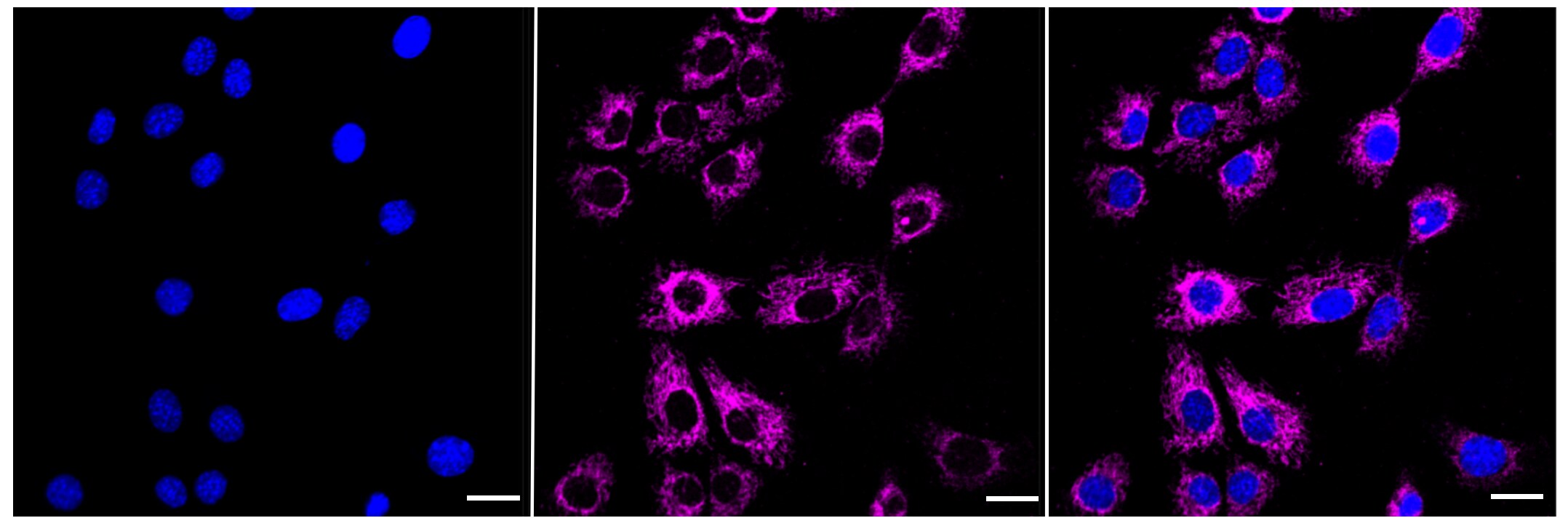 ACADS Antibody (23GB1365)