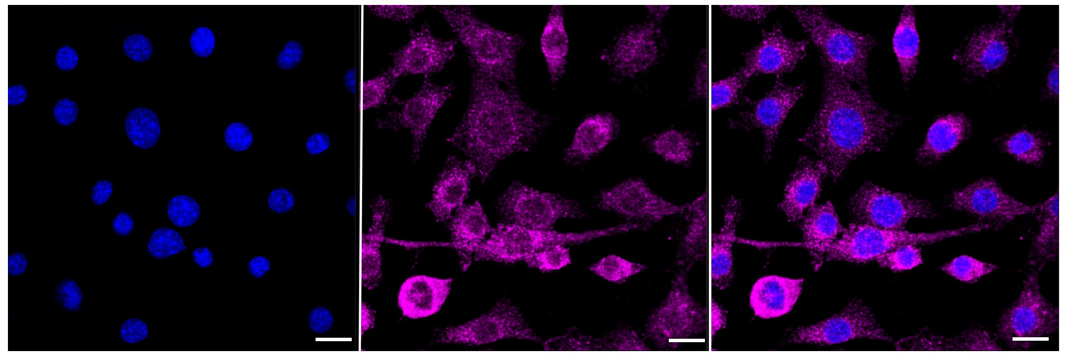 ACTR3 Antibody (23GB615)
