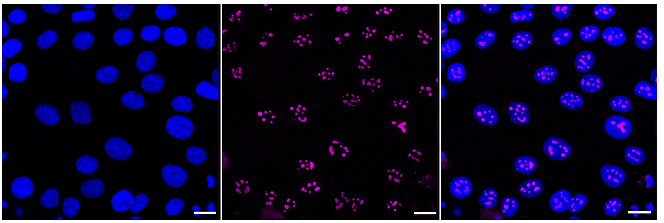 BAF53A Antibody (23GB1155)