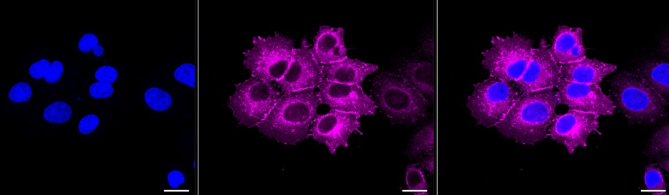 EGFR Antibody (23GB815)