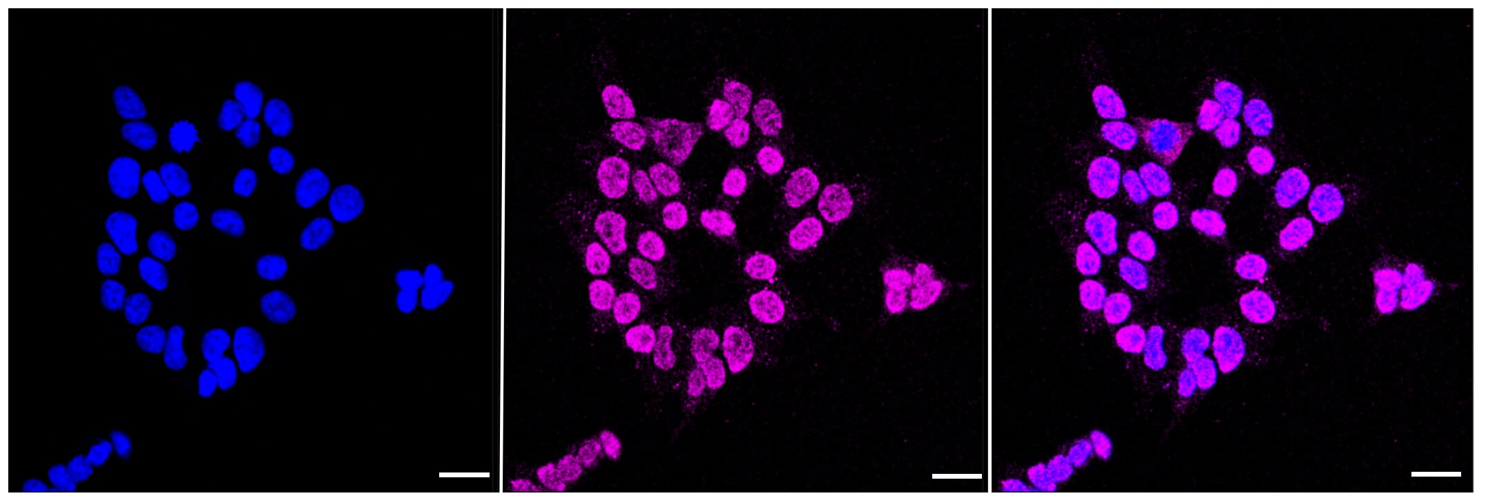 ADK Antibody (23GB625)