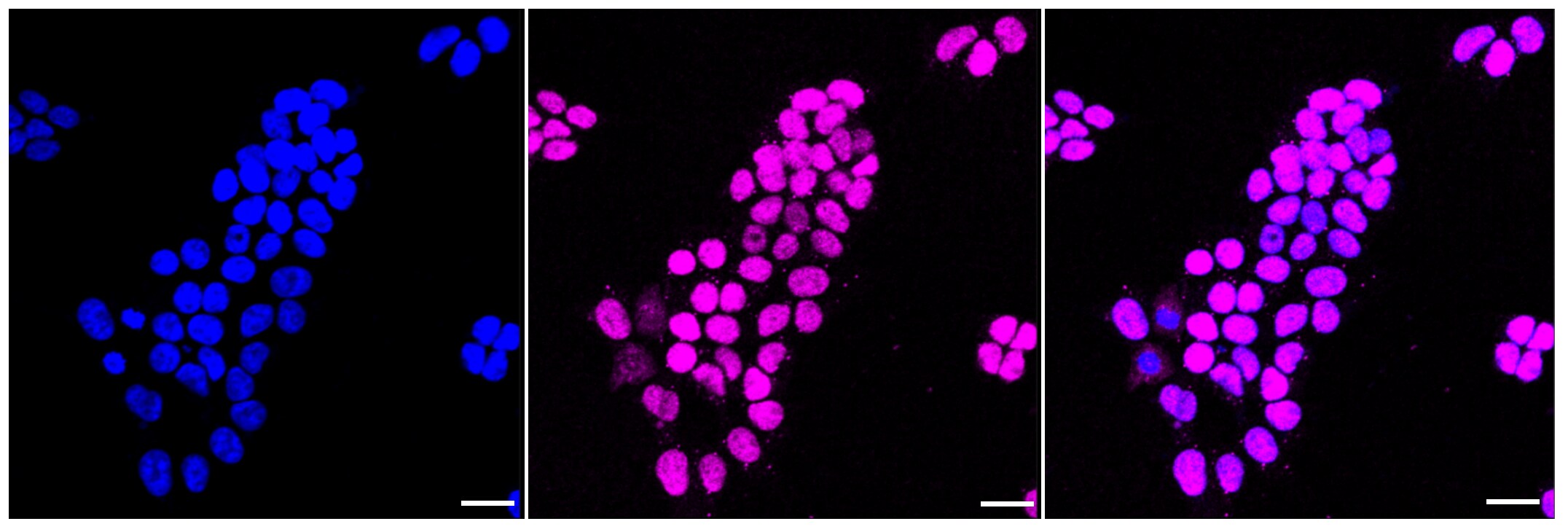p27/Kip1 Antibody (23GB1825)