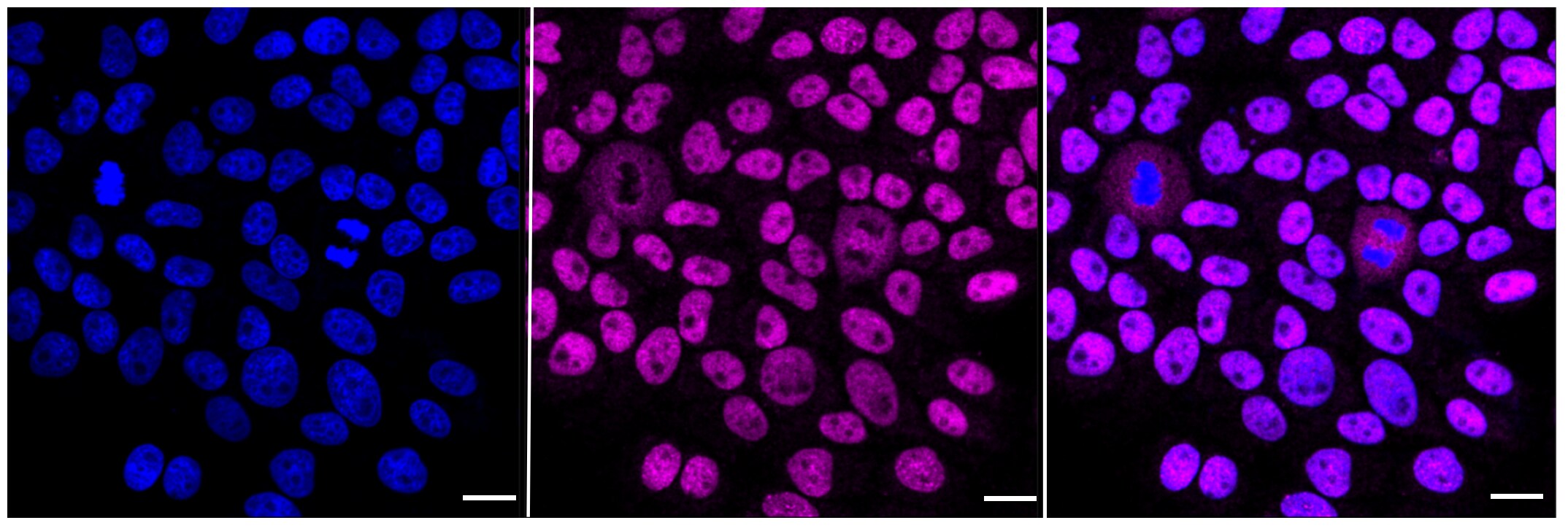 CHAF1A Antibody (23GB755)