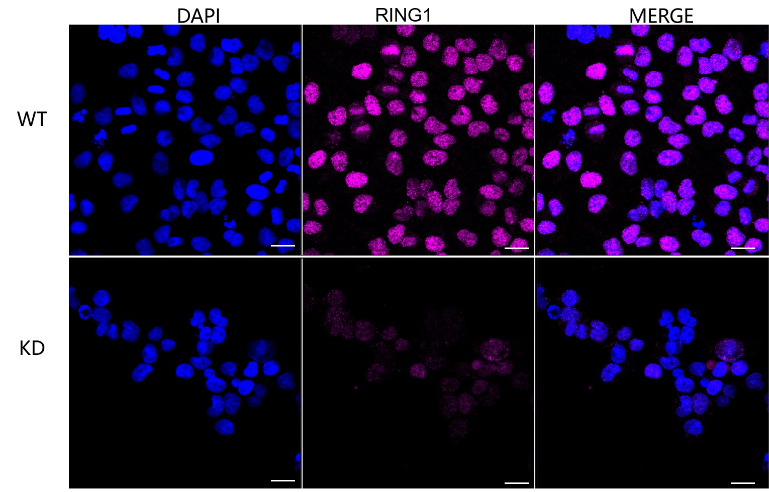 RING1 Antibody (23GB955)