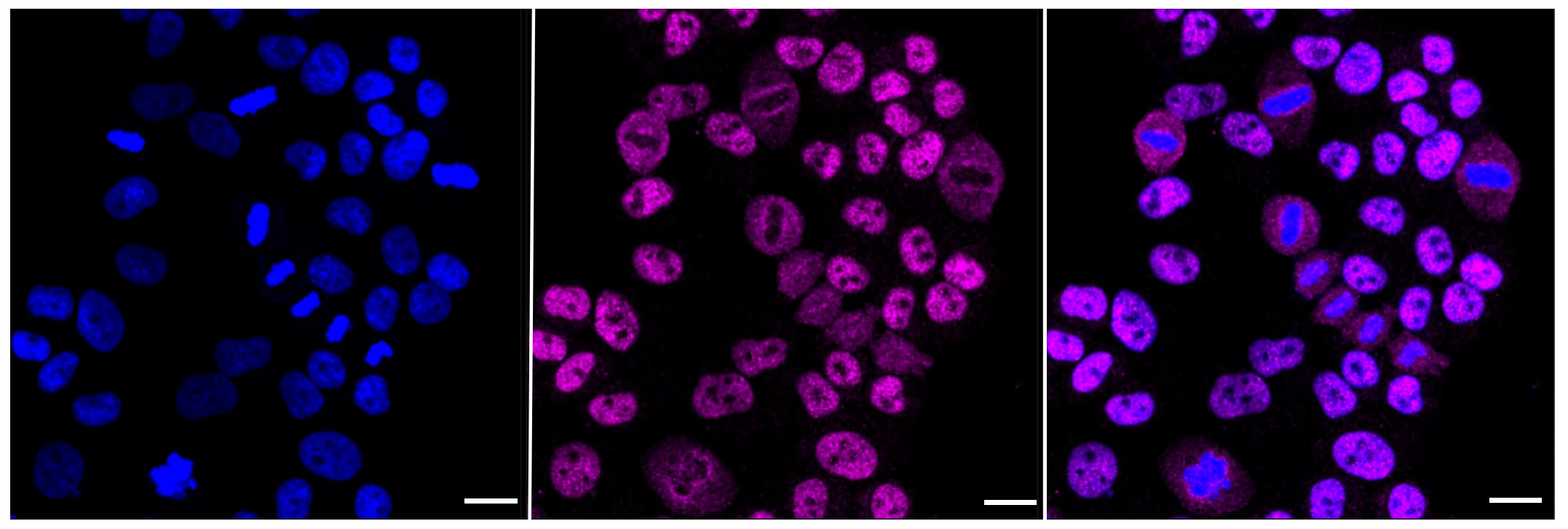 RING1 Antibody (23GB955)