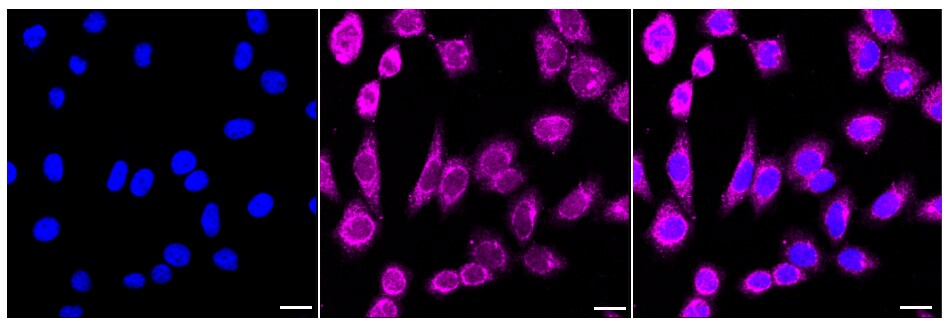 BDNF Antibody (23GB3005)