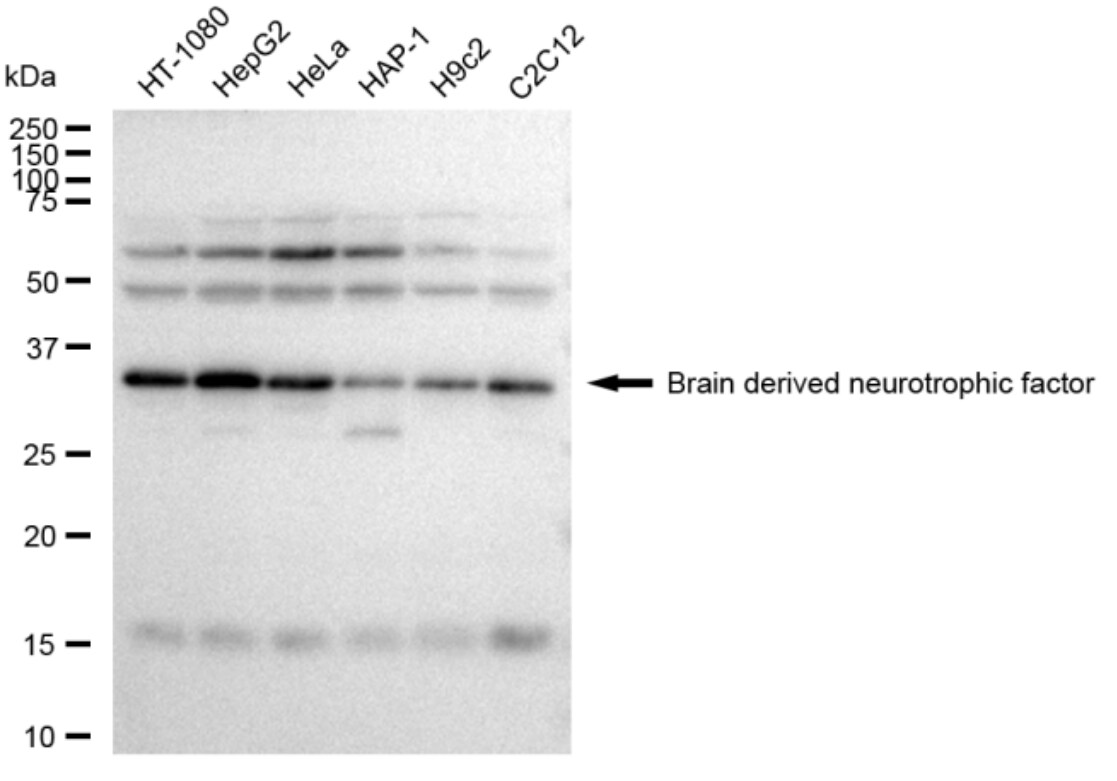 BDNF Antibody (23GB3005)