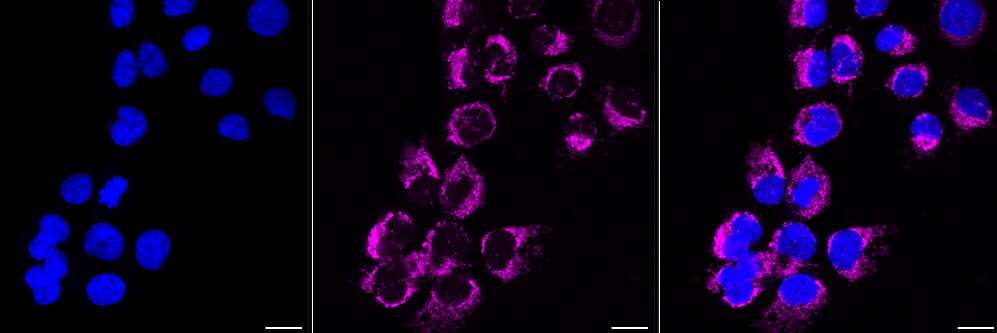 Hexokinase 1 Antibody (23GB870)