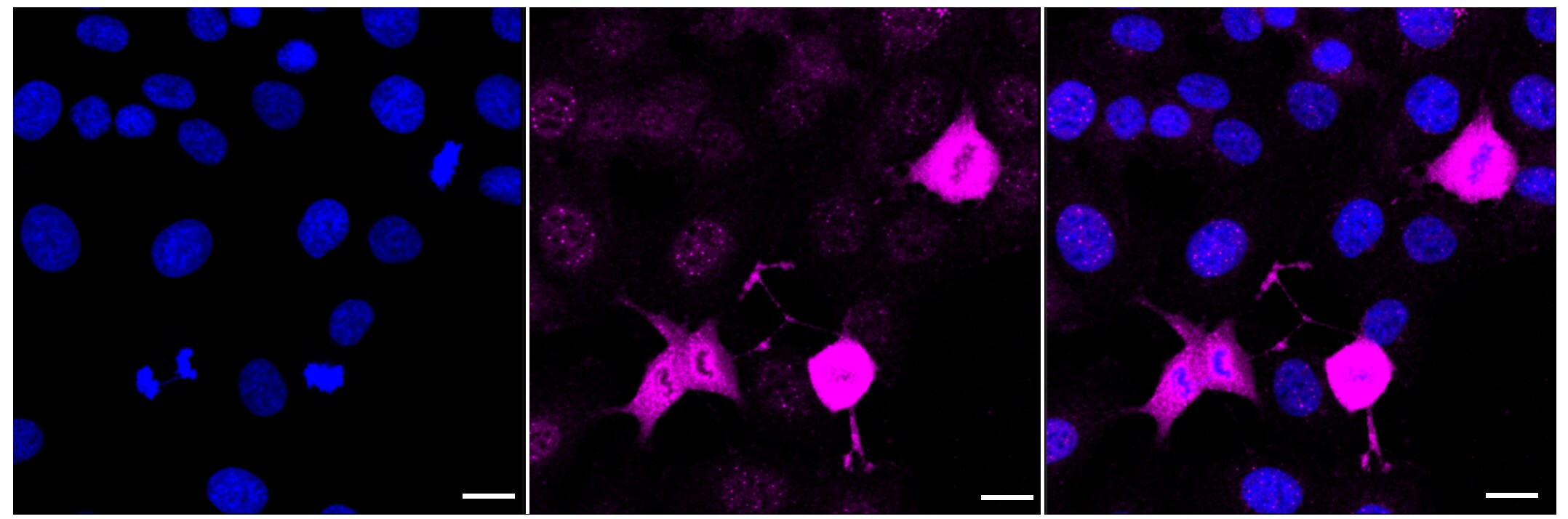 PKC alpha [p Ser657] Antibody (23GB1055)